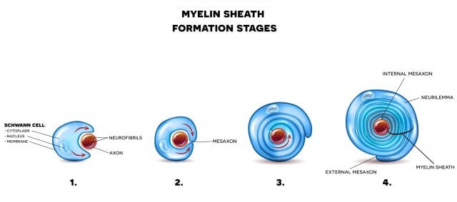 Demyelinating Diseases: A useful guide to diseases involving myelin