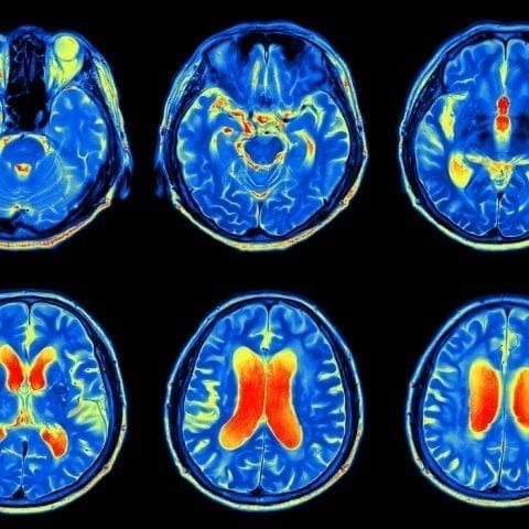 ‘Epidemic’ of brain injuries in New Zealand